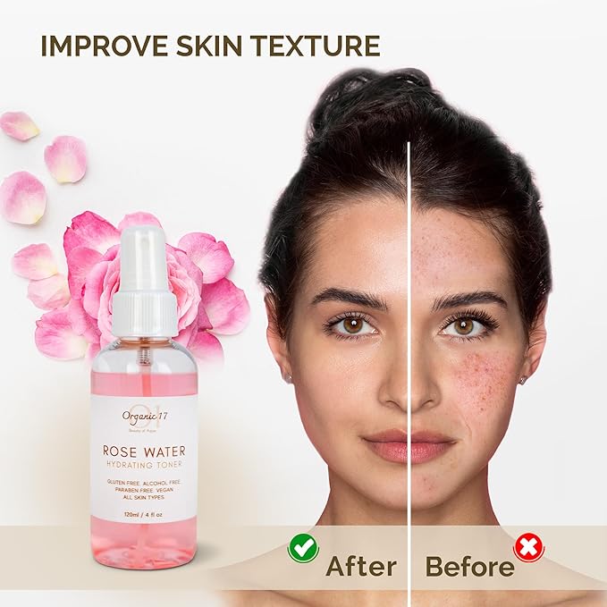 Rose Collection Skincare Gift Bundle – Hydrating, Brightening & Exfoliating Skincare Set for Radiant, Smooth Skin