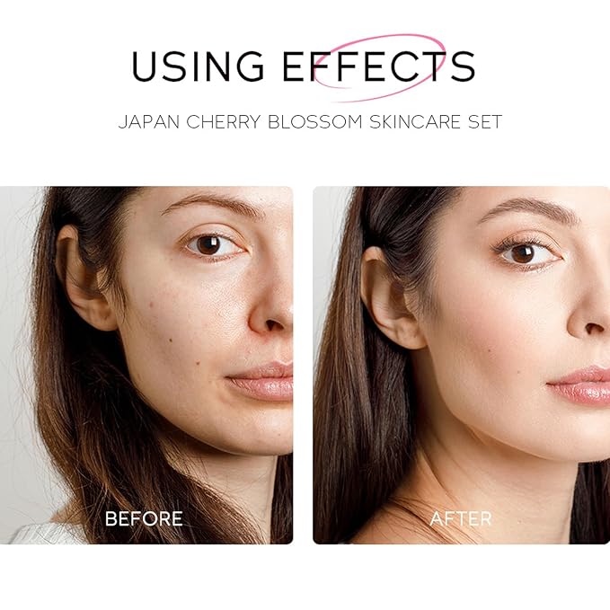 Sakura Face Care Set for Women, 17Pcs Moisturizing Skin Care Set Include Sakura Cream, Cleanser, Serum, Toner, Eye Cream, Lip Mask, Mud Mask, Sleeping Mask, Skin Care Routine for Daily Beauty Care