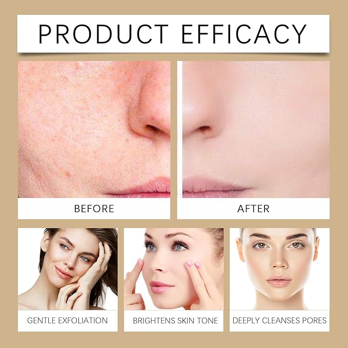 Rice Toner - Hydrating Moisturizing Essence Water, Oil Control & Brightening Skin For Dull Dry Skin(2PCS)