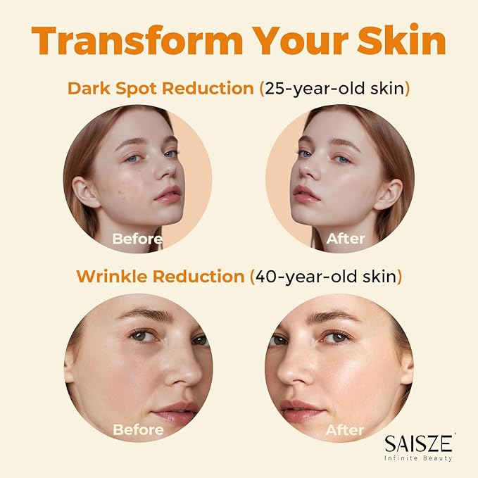 Vitamin C Serum for Face, Facial Serum for Dark Spot, Skin Care Gifts for Women, Anti Aging with Vitamin C, Hyaluronic Acid, 60ml