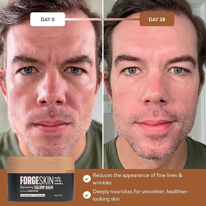 Forge Skin® Wrinkle Defense Beef Tallow Balm for Men [TALLOW-BASED] Moisturizer for Face Hydration - Hydrating Anti Aging Skin Cream - Natural Facial Skincare Lotion with Essential Oils (1.7 OZ)