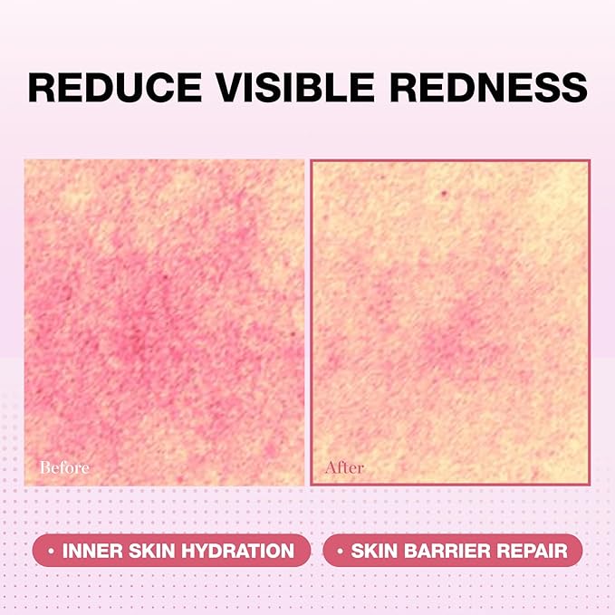 Physiogel Red Soothing Essence, Reduces Redness, Hydration for Dry & Sensitive Skin, Fragrance-Free, Non-Comedogenic, Dermatologist-Tested, Lightweight
