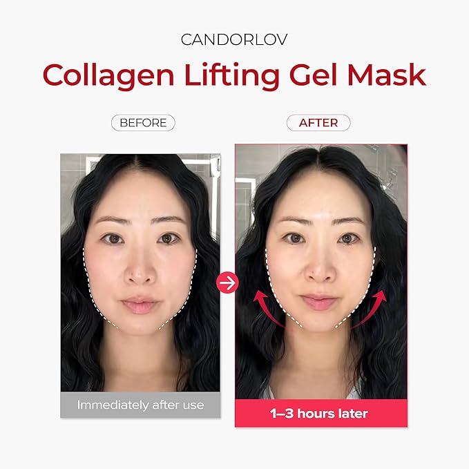 CDL Korean Collagen Duo - Collagen Hydrogel Face Lifting Mask (5 Sheets) + Collagen Hydrating Glass Glow Cream - Anti-Aging, Firming & Plumping with OLIGO-HA Phyto-PDRN