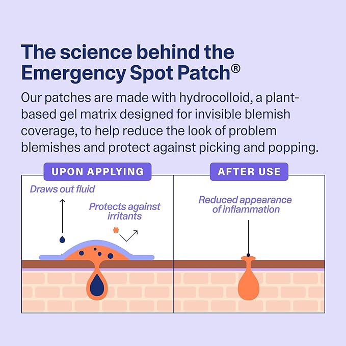 Curology Emergency Spot Pimple Patches for Face, Hydrocolloid Pimple Patches Fast-Acting, 80 Count