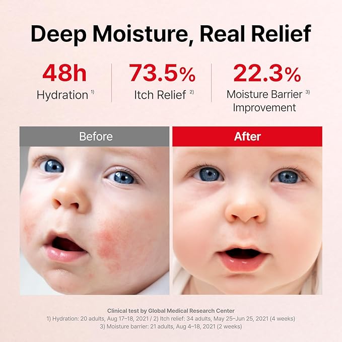 ATOPALM | MLE Eczema Cream | Premium Baby Lotion Newborn | Baby Face and Body Moisturizer for Skin Barrier | Moisturizing Facial Cream for Itchiness & Redness | Korean Skincare | 2.2 fl oz (65ml)