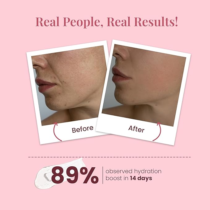 La Pink Ideal Bright Face Toner With 100% Microplastic Free Formula For Glass Brightening, Lightening, Evens Skin Tone For All Skin Types | 100 ml White