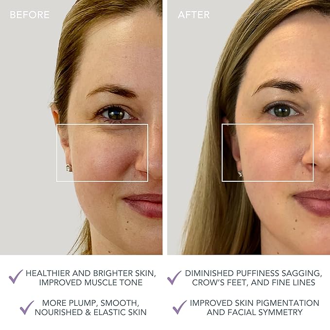FOREO Bear mini App-Connected Microcurrent Facial Toning Device with 3 Intensities, Lavender