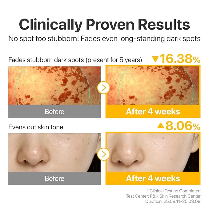 numbuzin No.5 Glutathione TXA Dark Spot Ampoule, Targeted Tone Care Concentrate for Dark Spots & Uneven Skin, Tranexamic Acid, Niacinamide, Vitamin Tree Water, Korean Skincare, 10.7g