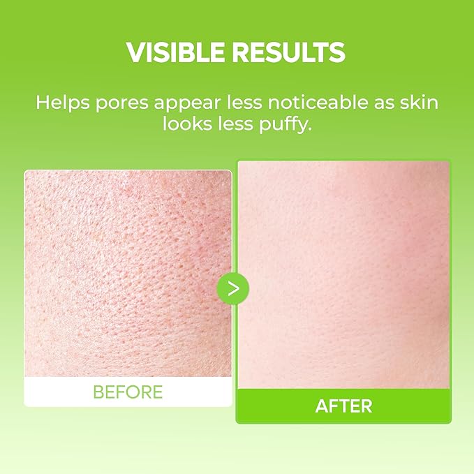 Dr.Melaxin CACTOX DE-PUFFING PORE TOX GEL MASK 4EA with Cactus Cooling Reduce Puffiness & Pore Tightening for Visible Pore Care Skin Repair