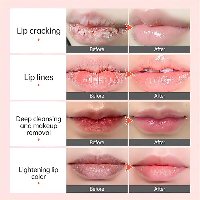 Remove Dark Lip Balm Lightening Melanin Mask Gloss Exfoliating Lip Pink Treatment Reduce Lip Lines Improve Dryness Moisturizing