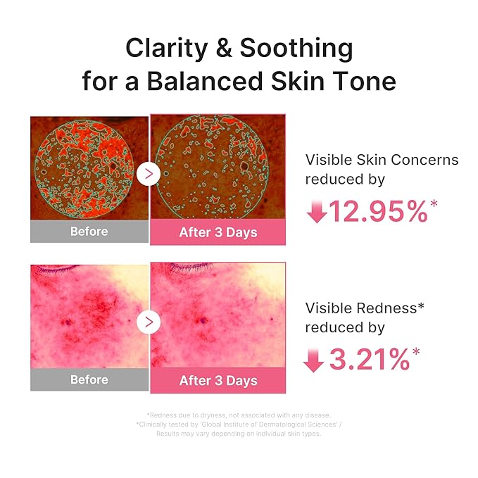 medicube Ultra Light PDRN Pink Peptide Serum | Lightweight Hydrating Serum with Salmon PDRN & Hyaluronic Acid | Fast-Absorbing Glow Care for Skin Clarity | Korean Skincare 1.01 fl. oz.