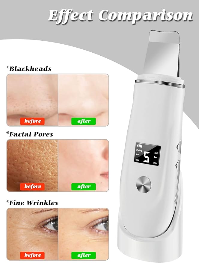 Skin Scrubber Face Spatula, 4 in 1 Blackhead Remover Tool for Pore Cleaner, Skin Scrubber Face Spatula for Facial Deep Cleansing with USB Charger