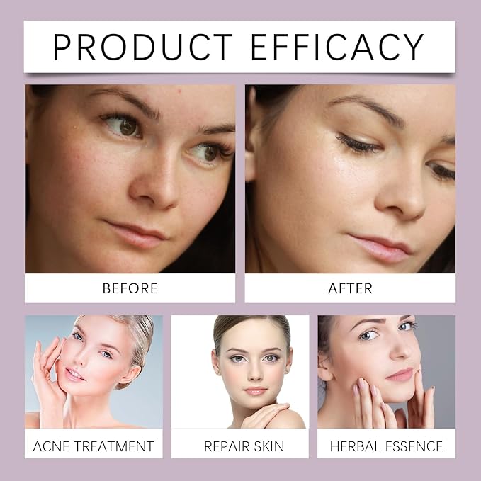 Hydrating Wet Toner - Deep Moisturizes, Locks Water, Plumps Skin, Reduces Fine Lines, Brightens Complexion(1PCS)