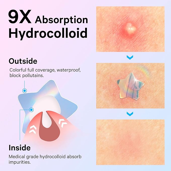Sosky Hologram Pimple Patches for Face, Hydrocolloid Acne Patches with Salicylic Acid, Cute Star Zit Stickers,Colorful Blemish Covers,48 Count Blue Pink Heart Cloud Butterfly Flower