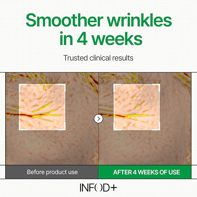 INFODPLUS Korean Skin Care Sensitive Face Cream, Lightweight Moisturizer with Ceramides & Panthenol, Skin Barrier Support & Deep Hydration, Low pH Daily Cream for AM/PM Use, 50ml