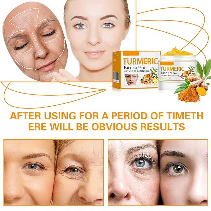 Turmeric Face Cream – Natural Turmeric Moisturizer Cream For Dark Spots Remover,Evens Skin Tone, Face Cream Smoothes Fine Lines, Daily Moisturizer For Face And Body