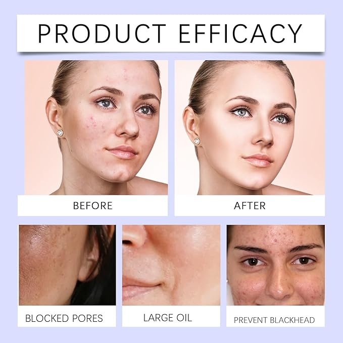 Hydrating Toner: Oil Control, Pore Minimizing, Quick Absorption, Gentle & Long-Lasting Moisture(2PCS)
