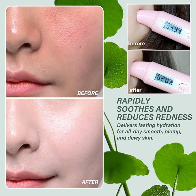 5PCS Centella Face Skin Care Set with Centella Serum,Toner and 3 face masks,Moisturizing Centella Toner Facial Kit,Hydrating Centella Kit Skin Care Gift Set,Nourishing Travel Size Skincare Set