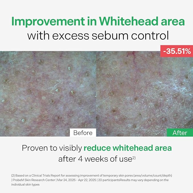 Torriden BALANCEFUL Control Serum 50ml (1.69 fl.oz.) | Daily Sebum & Oil Control for Sensitive Skin | 5D Complex Cica, 4% Niacinamide | Korean Facial Serum