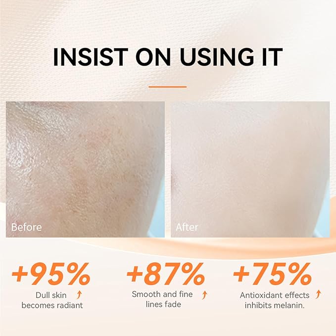 5X Vitamin C 20% Serum for Face with Hyaluronic & Amino Acids - Boost Skin Collagen, Hydrate & Plump Skin, Anti Aging & Wrinkle Facial Serum, All Skin Types, 30 ML / 1.0 Fl Oz (Vitamin C Serum)