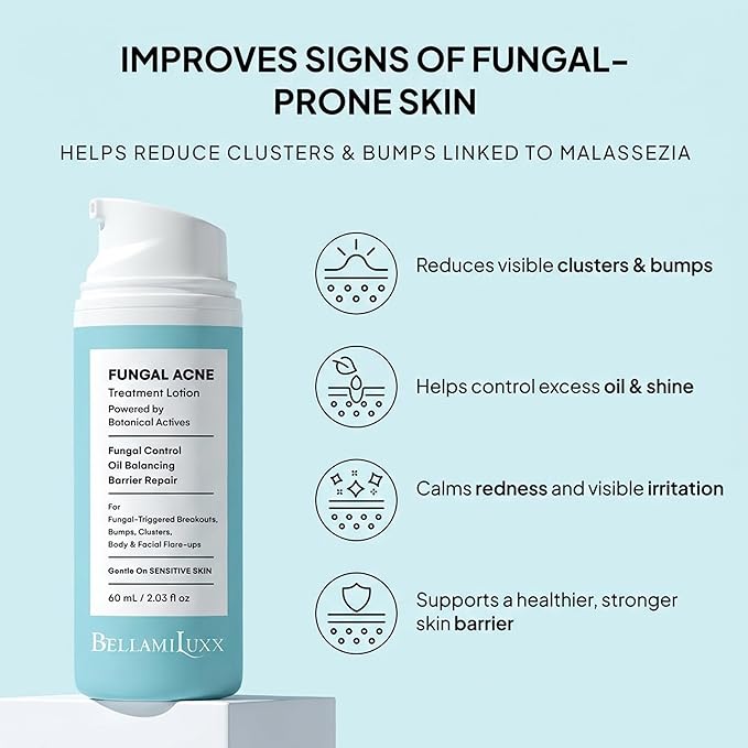 Fungal Acne Treatment Lotion: Effective Face & Body Pimple Cream for Bumps, Clusters, Itch & Redness – Fungal Prone Skin Acne Treatment Moisturizer for Teens & Adults with Natural Actives