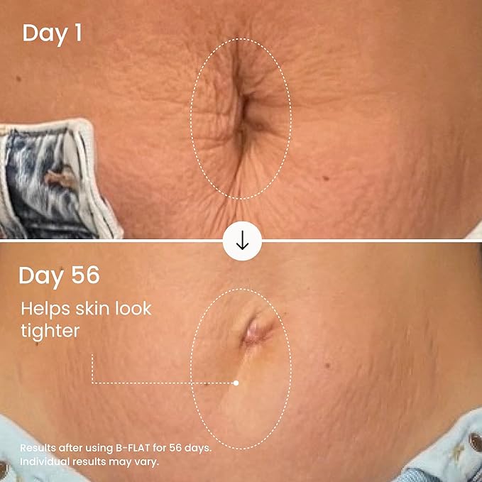 MAËLYS B-FLAT Belly Firming Cream for Women - Skin Tightening & Moisturizing Treatment with Shea Butter & Bentonite Clay - Smooths Look of Stretch Marks - Postpartum Body Care (3 Pack)