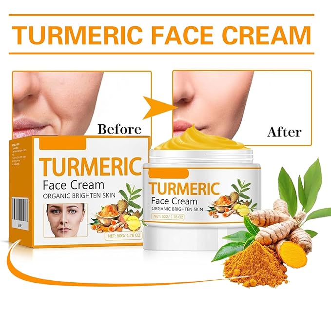 Turmeric Face Cream – Natural Turmeric Moisturizer Cream For Dark Spots Remover,Evens Skin Tone, Face Cream Smoothes Fine Lines, Daily Moisturizer For Face And Body