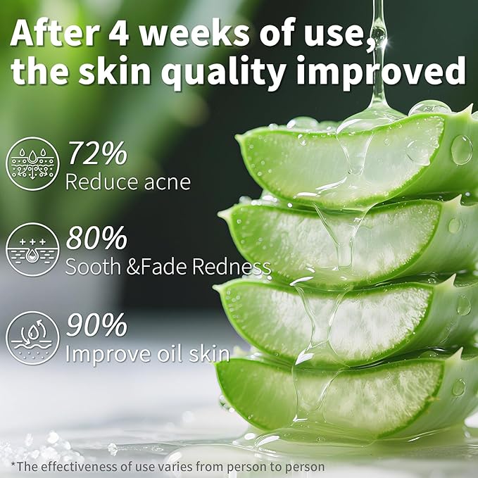 Aloe Vera Gel, Organic Moisturizing Cream Soothing and Hydrating for Face, Skin, Hair & Sunburn Relief, 100% Pure Aloe Gel for All Skin Types-300ml (10.1fl.oz)