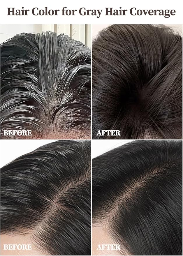 Hair Dye + Ampoule Anti Hair Loss Treatment, Permanent Hair Color, 100% Gray Coverage, 2-Step Shampoo + 5-Minute Hair Color for Women & Men & Scalp Care Formula (BLACK)