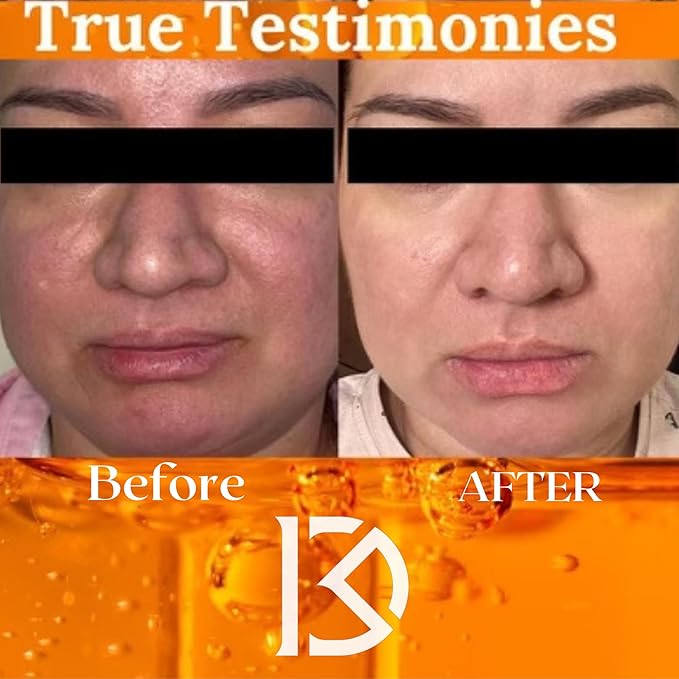 Glycolic Acid Face Wash Exfoliating Face Cleanser B3 Niacinamide Cleanser Instant Makeup Remover 10% Glycolic Acid Pore Minimizer Exfoliating face wash for Women & Mens face wash All in1- All U Need