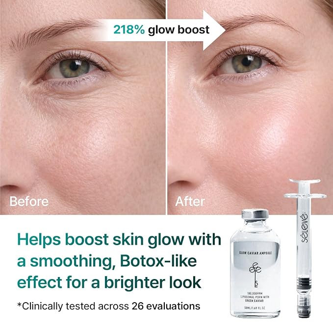 Glow Caviar Hydrating Prep & Serum Duo – Bubble Toner + Glow Ampoule with Green Caviar PDRN, Niacinamide & Ferulic Acid – Korean Skincare for Sensitive & Dry Skin