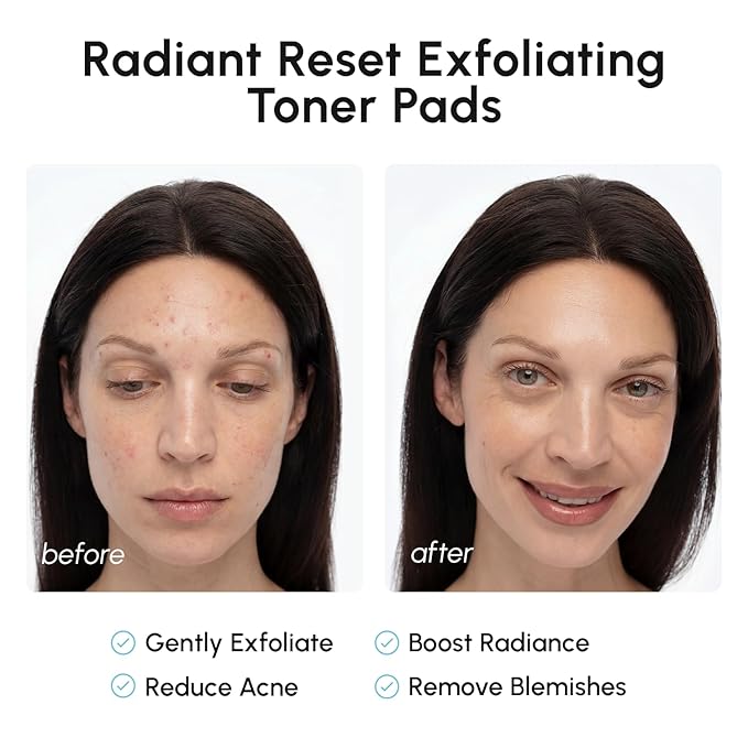 MAREE Glycolic Acid Resurfacing Pads - Toner Pads for Face Cleansing - Exfoliating Pad with Tea Tree Oil, Salicylic Acid & Vitamins E, B3, B5 - Facial Device for Pore Resurfacing & Radiance - 50 Count