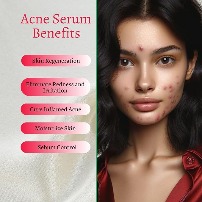 gymsegbë Acne Set: Cleanser, Toner, Serum, and Acid Peel