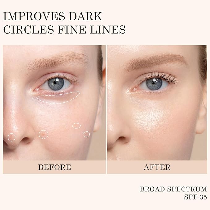 KYDA Mineral Eye Cream, Tined Eye Cream Color Corrector, 3-in-1 Anti-Aging Eye Cream for Dark Circle and Fine Lines, SPF 35, Light