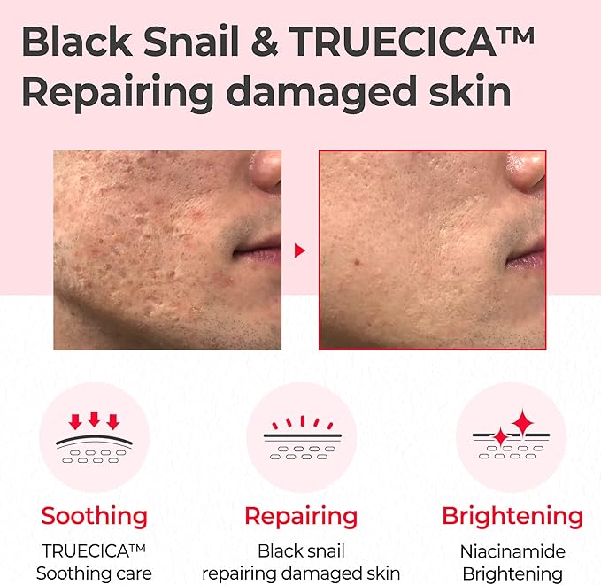 SOME BY MI Snail Truecica Miracle Repair Toner - 4.6Oz, 135ml - Made from Snail Mucin for Sensitive Skin - Daily Repair Face Toner with Skin Texture and Pigmentation Care - Korean Skin Care