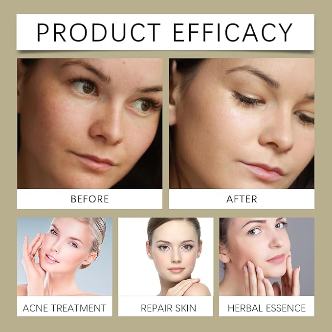Glycolic Acid 7% Toning Solution, Gentle & Refreshed OUHOE Glycolic Sour 7% Toning, Glycolic Sour 7% Toning, Soothes and Hydrates the Skin, Exfoliating Serum for Face, Astringe Pores (2pc)
