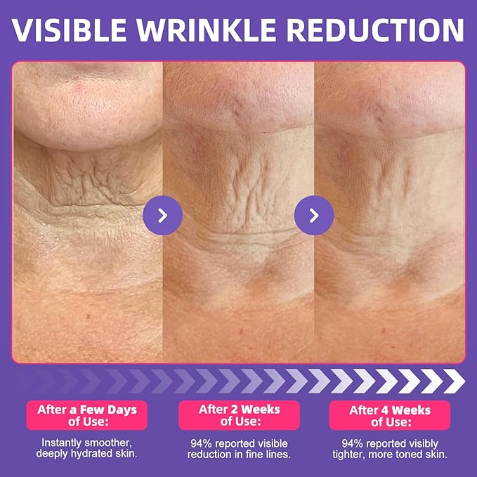 Neck Firming Cream with Roller, Neck Cream for Tightening and Firming with Retinol, Collagen & Niacinamide to Reduce Wrinkles, Tighten Sagging Skin & Lift Jawline