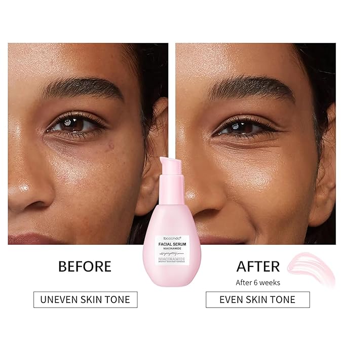 75ML Watermelon Niacinamide Serum, Watermelon Hydrating Serum With Hyaluronic Acid,Brighten Moisturizing,Lightweight Toner, 2.64Fl Oz