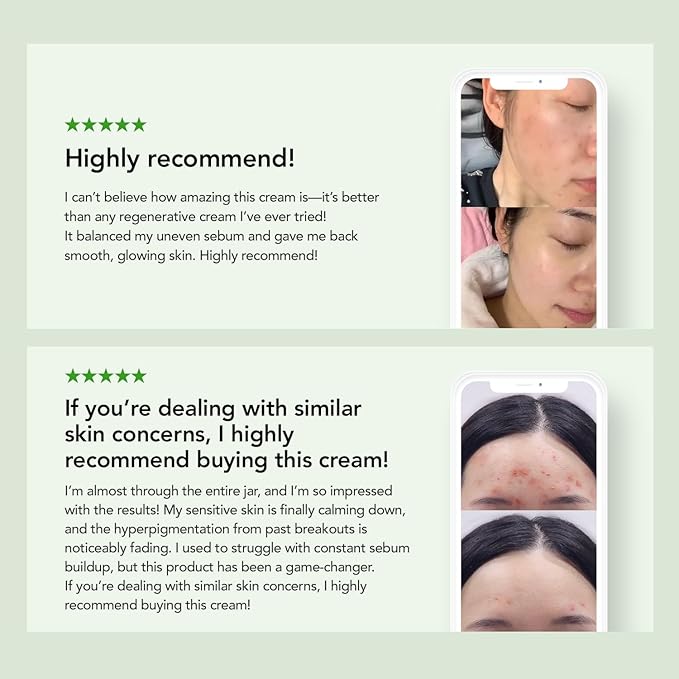 31% Reduction in Sebum & 15.5% High-Dose D-Panthenol | Calms Redness, Repairs Skin Barrier & Locks in Hydration | With Heartleaf Extract | Korean Skincare Daily Moisturizer (35 ml/1.18 fl.oz.)