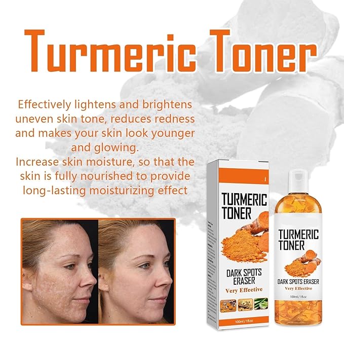 Turmeric Toner For Face - Deep Hydration, Brightening & Firming, Moisturizing To Smooth Skin, Even Tone, Reduce Redness(2PCS)
