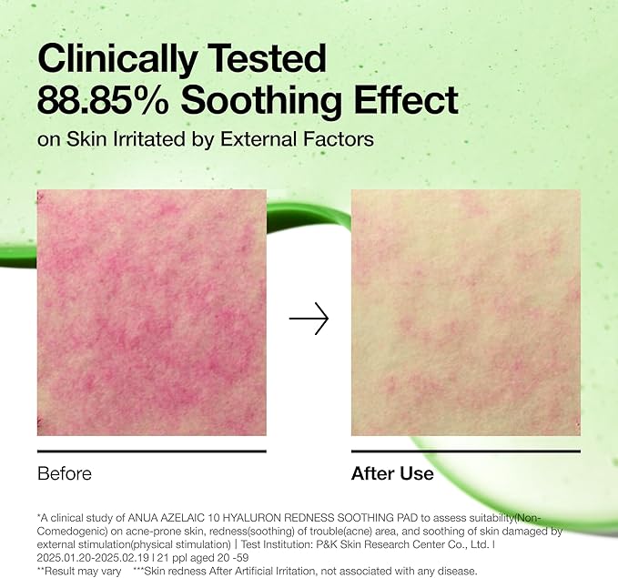 ANUA Azelaic 10 Hyaluron Redness Soothing Pad, Troubled & Spot Care, Quick & Easy Stretchable Facial Mask with Azelaic acid, Hyaluronic Acid, Korean Skincare (90 pads)
