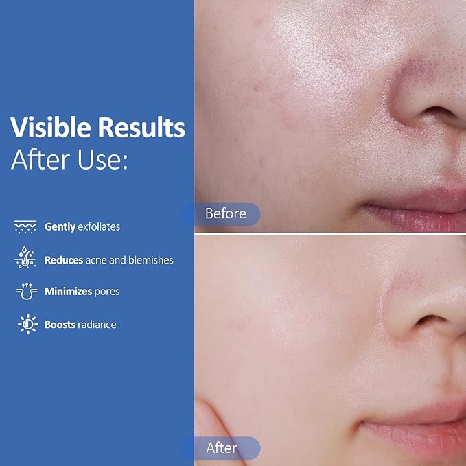 Glycolic Acid Exfoliating Pads, Dual-Textured Facial Toner for Pore Care & Skin Radiance, Deep Cleansing Peel with Niacinamide, Salicylic Acid & Vitamins E, B3, B5 (50 Pads)