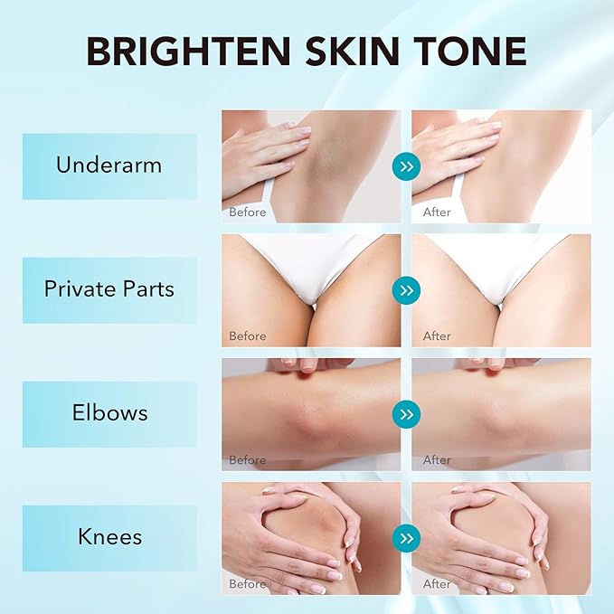 Skin Care - Skin Lightening & Bleaching Cream, Face Moisturizer with Vitamin C & Arbutin, Dark Spot Remover for Body & Intimate Areas, Underarm, Knees, Elbows, Inner Thigh, Private Parts- 1.7 Fl Oz