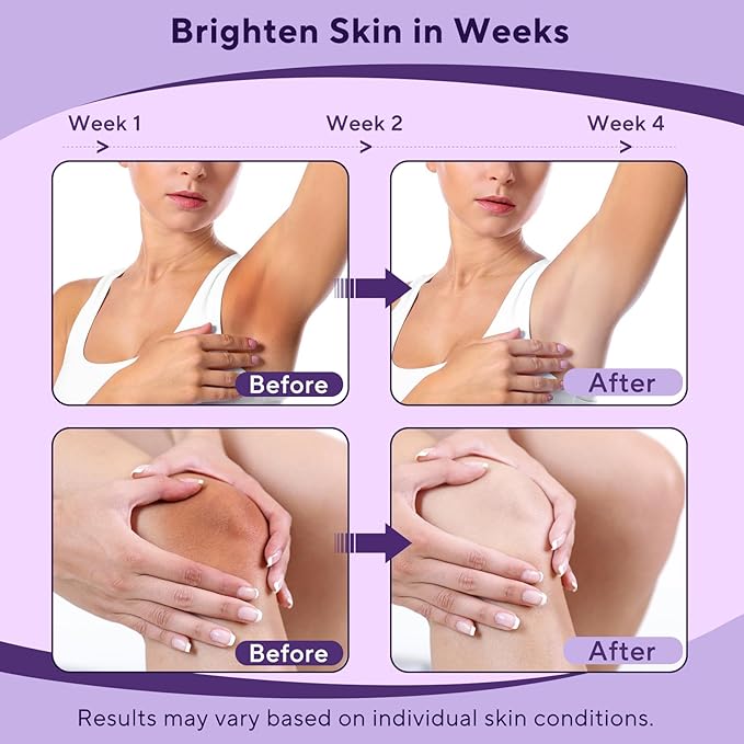Skin Bleaching Cream, Skin Lightening Cream with Vitamin C for Intimate Areas, Dark Spot Remover for Body, Sensitive, Face, Intimate Areas Underarms, Knees, Elbows, Inner Thighs & Bikini Line,1.7fl OZ