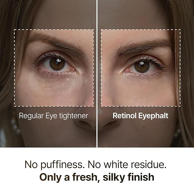Dr.Melaxin Retinol Eyebag Cream for Puffiness, Dark Circles & Fine Lines, Wrinkle, EGF Anti-Aging Under Eye Moisturizer with Niacinamide&Ceramide Makeup friendly korean skin care