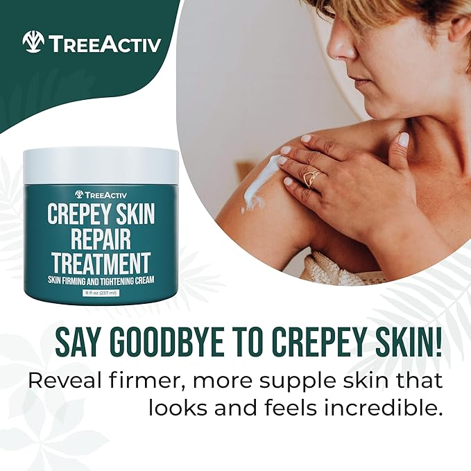 TreeActiv Crepey Skin Repair Cream, 8 oz Firming Body & Neck Cream with Hyaluronic Acid, Glycolic Acid & Shea Butter, Helps Crepey Skin Look Smoother, 500+ Uses