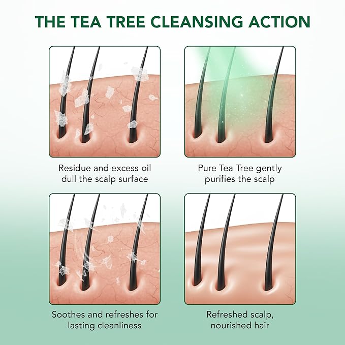 Botanic Hearth Tea Tree Shampoo 8Fl Oz And Conditioner 4 Fl Oz | With 100% Pure Tea Tree Oil, For Itchy And Dry Scalp, Sulfate/Paraben Free | For Men And Women