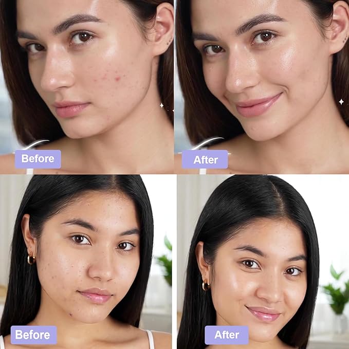 Madecassoside Toner Pads, Mild Exfoliating Pads, Calming Blemish Face Pad -Centella, Niacinamide, BHA Salicylic Acid for Soothe, Uneven Skin Tone, Dark Spots, Skincare 125 Pad