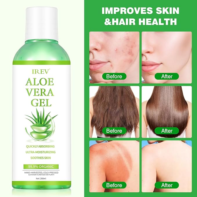 IREV Organic Aloe Vera Gel for Face, Skin, Hair, Sunburn Relief, Pure Aloe Vera Soothing Gel for Skin Care, Acne, After Sun Repair, After Shave, Cold Pressed, No Sticky Residue, Moisturizing-200ml