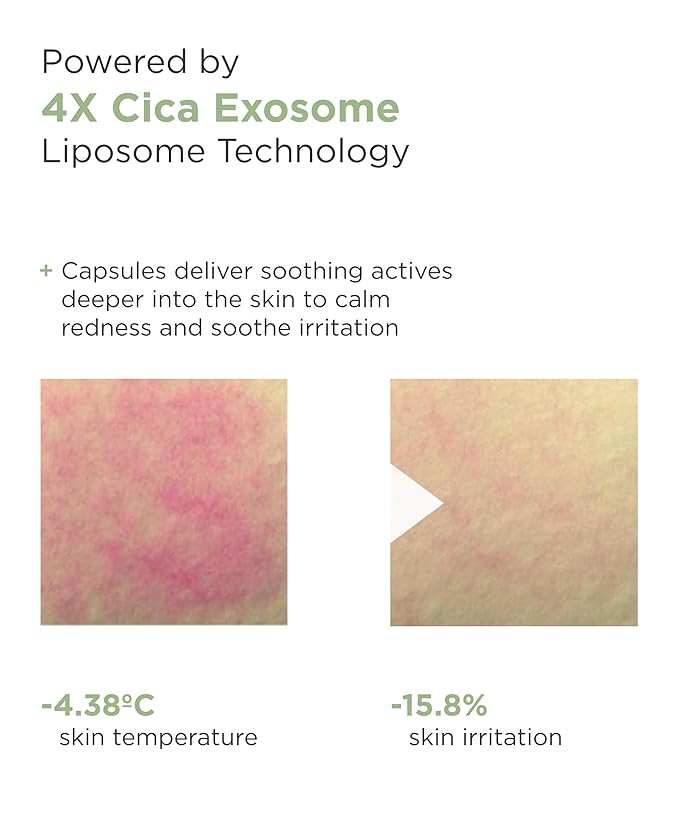AROCELL Cica Hydrogel PDRN Mask 7 Facial Sheet with Panthenol & Centella Asiatica, Cooling Hydrogel Face Mask for Soothing Calming Sensitive Skin Korean Skincare | BSS Skincare Must-Have | 25gx7ea